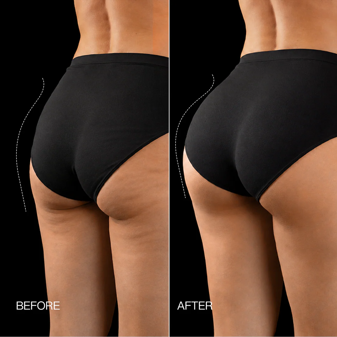 3-Zone EMS Toning Shorts: Targeted Abdomen, Glutes & Pelvic Floor Support